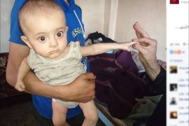الطفلة بيسان رأفت الشماع والتي تبلغ من العمر 9 أشهر.