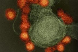A handout photo produced 19 May 2016 and provided by the National Institute of Allergy and Infectious Diseases (NIAID) on 04 August 2016 shows a transmission electron microscope image of negative-stained, Fortaleza-strain Zika virus (red), isolated from a microcephaly case in Brazil. Harris County Public Health in Texas, USA issued a statement on 09 August 2016 confirming a Zika-virus associated death of a baby girl., the first such death in Texas. The baby suffered from various birth defects, that also included microcephaly. EPA/NIH/NIAID / HANDOUT