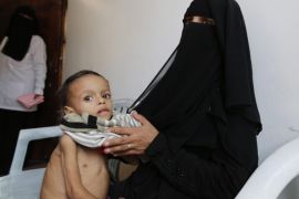 A Yemeni woman holds her child suffering from malnutrition in a charity medical center in Sana'a, Yemen, 14 December 2016. According to reports, the United Nations Children’s Fund (UNICEF) has announced that 2.2 million Yemeni children are suffering from severe malnutrition and are in urgent need of care due to a 20 month-conflict between the Saudi-backed Yemeni government and the Houthi rebels.