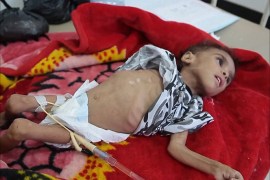 إرتفاع عدد حالات الكوليرا في اليمن