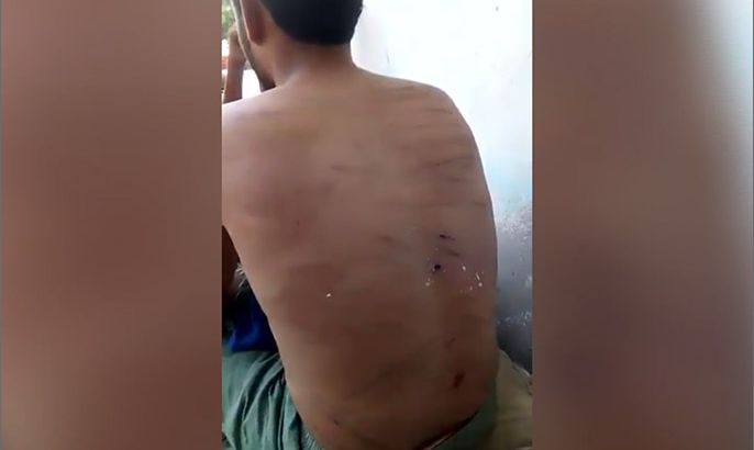فيديو لمواطن يمني تعرض للتعذيب بسجن إماراتي