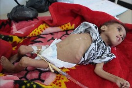 منظمات صحية: ارتفاع حالات الكوليرا باليمن إلى 200 ألف