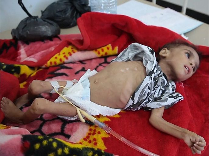 منظمات صحية: ارتفاع حالات الكوليرا باليمن إلى 200 ألف