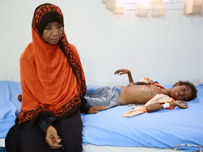 A woman carries her son Imran Faraj, 8 year-old, who is suffering from malnutrition at a hospital in the Red Sea port city of Hodeidah June 13, 2017. REUTERS/Abduljabbar Zeyad