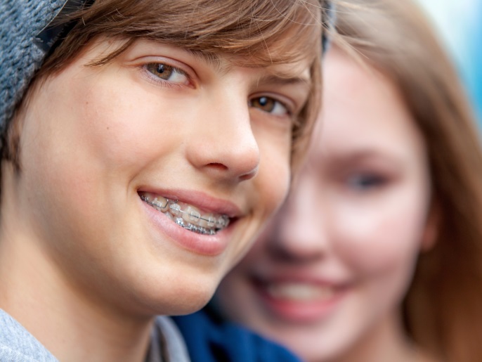 إذا قرر الآباء علاج اعوجاج الأسنان لدى الطفل، فيتعين البدء قبل اكتمال نمو الفك. ويتراوح العمر المناسب لذلك من 10 إلى 13 سنة. (النشر مجاني لعملاء وكالة الأنباء الألمانية 