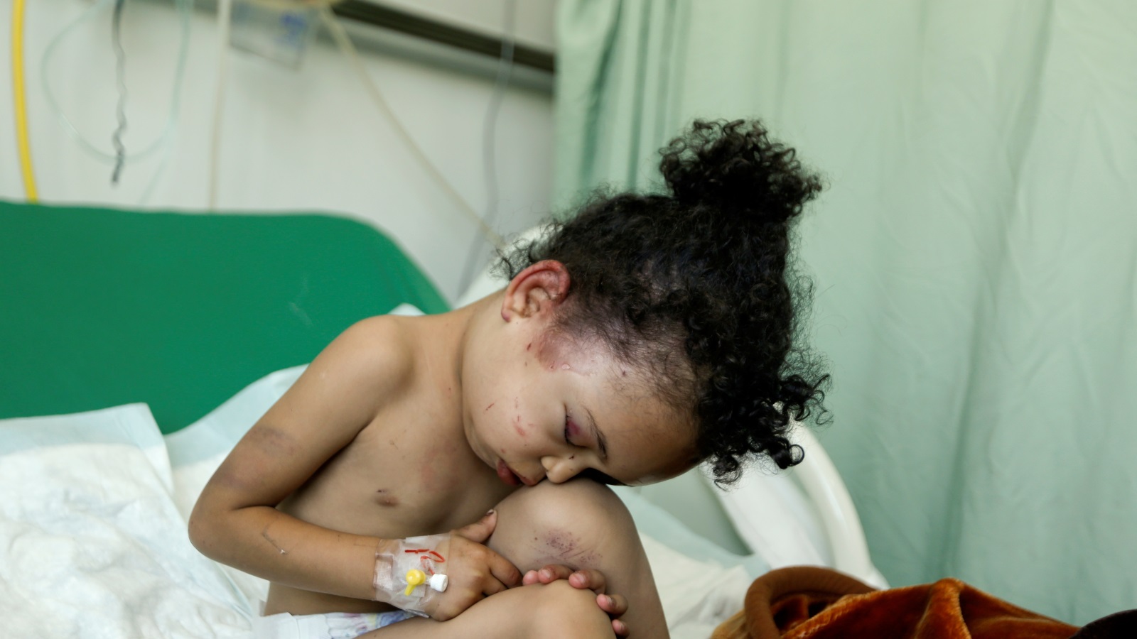 الطفلة اليمنية بثينة الناجية من قصف منزلها في صنعاء يوم 26 أغسطس/آب 2017 بعد مقتل عدد من أفرادها (رويترز)