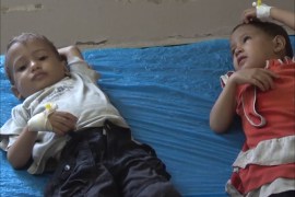 اليونيسيف تعد اليمن أسوأ مكان للأطفال