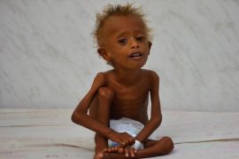 Salem Abdullah Musabih, 6, sits on a bed at a malnutrition intensive care unit at a hospital in the Red Sea port city of Hodaida, Yemen September 11, 2016. REUTERS/Abduljabbar Zeyad SEARCH