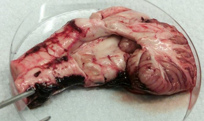 A part of a cow brain is ready to be examined for bovine spongiform encephalopathy (BSE), that causes the new variant Creutzfeldt-Jakob Disease in a veterinary examination institute in Krefeld December 6, 2000. From today every slaughtered cow older than 30 months has to be tested for the mad cow disease.
