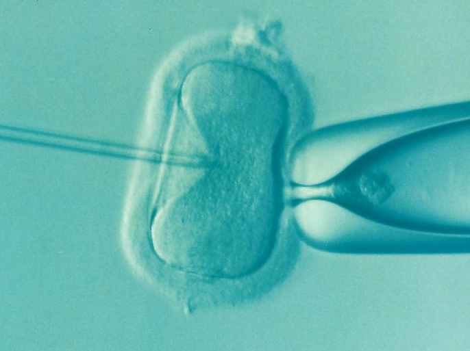 التلقيح الصناعي In vitro fertilisation (IVF) ، المصدر: بيكسابي