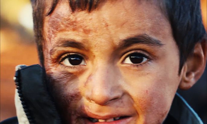 أول فيلم يوثق الاضطرابات النفسية لدى أطفال سوريا