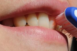 أسنان، لثة، صحة الفم، المصدر: بيكسابي
