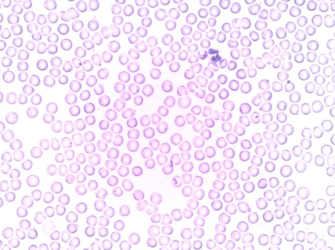 خلايا الدم البيضاء (بيكسابي)