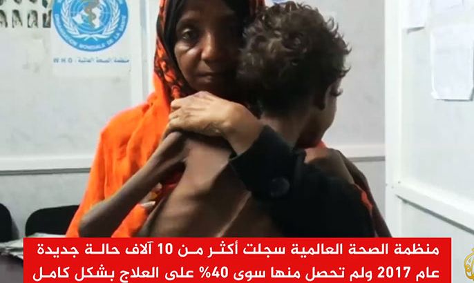 30 ألف حالة سرطان سنويا في اليمن