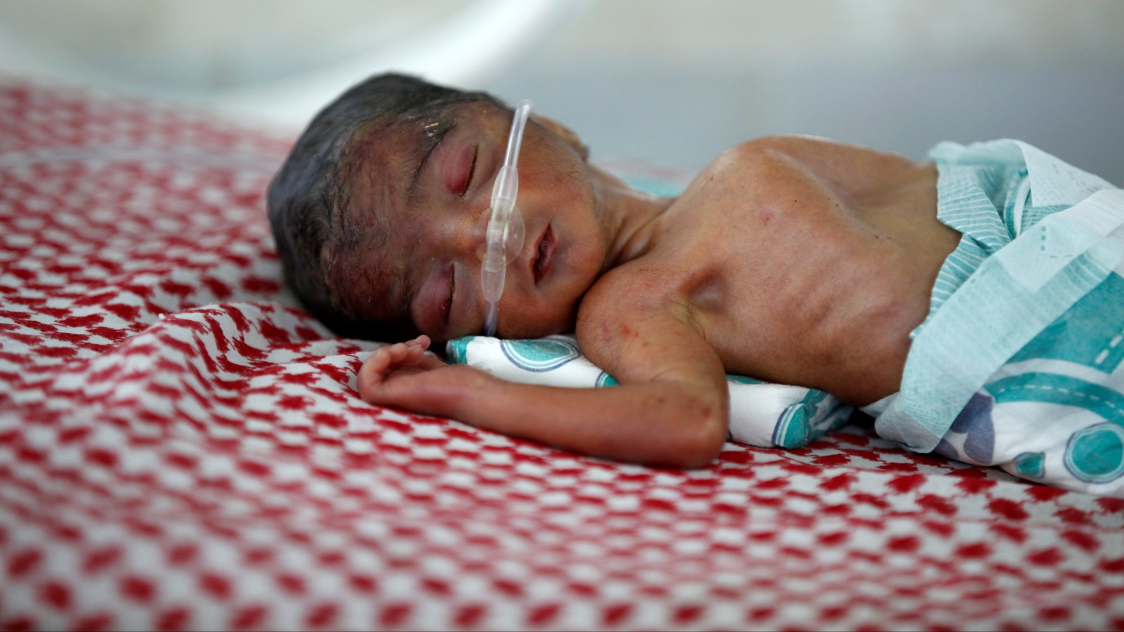 ‪يونيسيف: 400 ألف طفل يمني يواجهون خطر الموت جوعا‬  (رويترز)