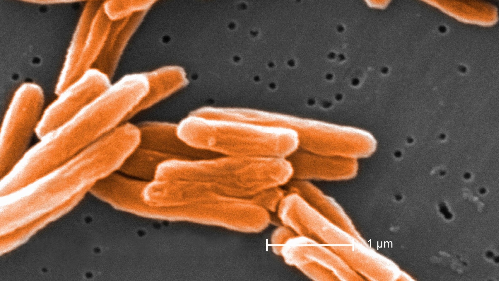 ‪بكتيريا السل تحت المجهر‬ (غيتي)