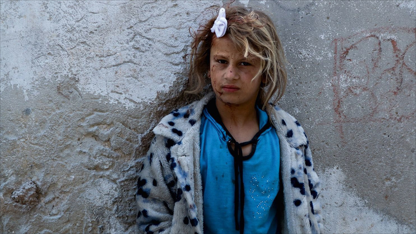 فتاة جريحة تحتمي بحائط قرب موقع في مدينة حلب طاله قصف القوات الحكومية بالبراميل المتفجرة(الصحافة الأميركية)