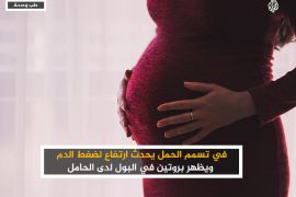 في تسمم الحمل يحدث ارتفاع لضغط الدم ويظهر بروتين في البول لدى الحامل