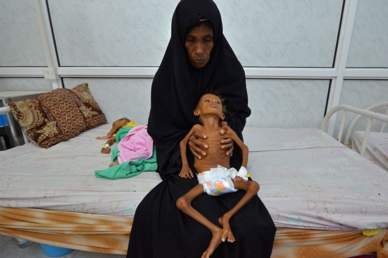 Salem Abdullah Musabih, 6, is held by his mother as she sits on a bed at a malnutrition intensive care unit at a hospital in the Red Sea port city of Hodaida, Yemen September 11, 2016. REUTERS/Abduljabbar Zeyad TPX IMAGES OF THE DAY SEARCH