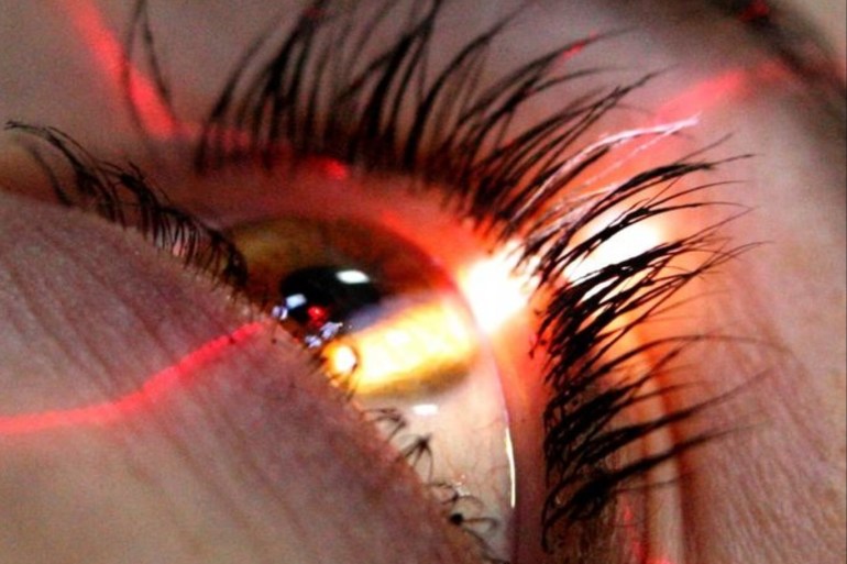 الجراحة الليزرية لتغيير لون العين بحاجة للمزيد من الدراسة