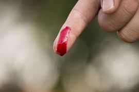 لماذا تؤلم الجروح التي تسببها الأوراق بشدة؟ جروح جرح إصبع إصبع (بيكسابي)