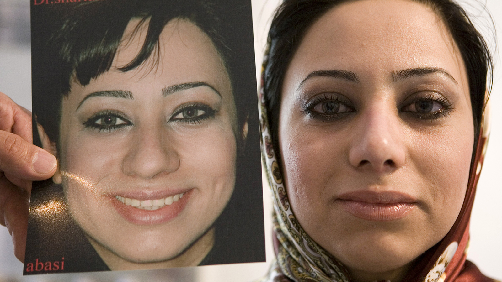 ‪إيرانية قبل وبعد عملية جراحية لتجميل الأنف‬ (رويترز)