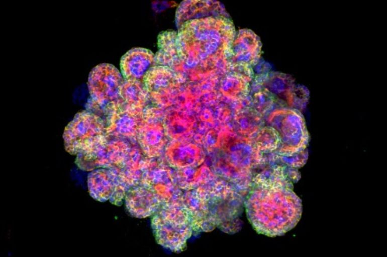 A confocal image of a trophoblast organoid stained for cytokeratin 7, F-actin and Dapi is seen in this undated picture handed out by the University of Cambridge, Britain. Margherita Turco/University of Cambridge/Handout via REUTERS ATTENTION EDITORS - THIS IMAGE WAS PROVIDED BY A THIRD PARTY.