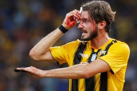 Soccer Football - Champions League - Third Qualifying Round Second Leg - AEK Athens v Celtic - Athens Olympic Stadium, Athens, Greece - August 14, 2018 AEK Athens' Marios Oikonomou after sustaining a head injury REUTERS/Alkis Konstantinidis