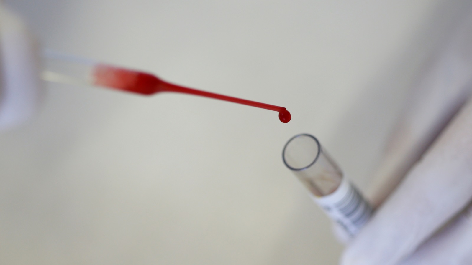 التكنولوجيا المستخدمة لقياس نسبة التروبونين في الدم أصبحت متطورة (رويترز)