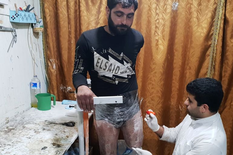 الفني غزال هلال يأخد قياسات لصناعة طرف صناعي لشاب أصيب ببتر في الساق بسقوط قذيفة/ سوريا حلب/ اعزاز بالريف الشمالي.