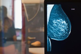 ⁨تحميل صورة في ألمانيا .. أيدي المكفوفين لتشخيص سرطان الثدي!⁩