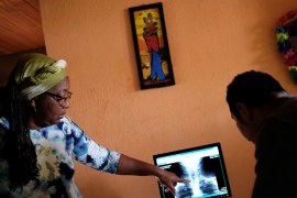 Lina, who said she was raped by dozens of right-wing paramilitary fighters in the Montes de Maria region during the five-decade civil war, and her husband Alvaro look at her thyroid cancer radiograph inside their house in Soacha, on the outskirts of Bogota, Colombia, June 11, 2018. Lina is determined to speak to the truth tribunal after she - and many women like her - was forced to remain silent during the conflict because paramilitary fighters controlled local authorities.