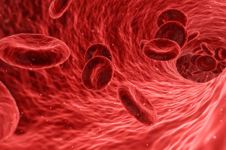 صور من بيكسابي ثلاسيميا كرات دم حمراء تلاسيميا thalassemia