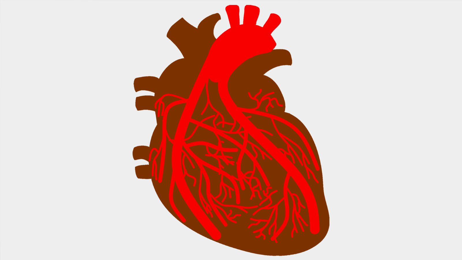  عدم انتظام ضربات القلب قد يسبب توقف القلب عن الضخ تمامًا (بيكسابي)