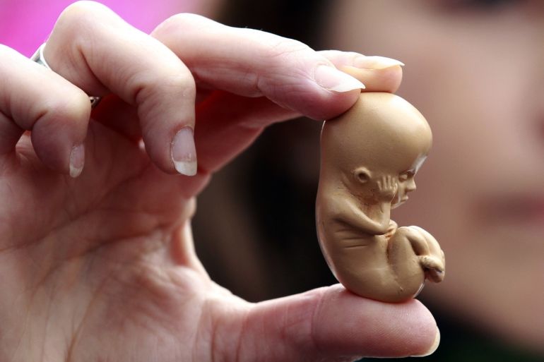A pro-life campaigner holds up a model of a 12-week-old embryo during a protest outside the Marie Stopes clinic in Belfast October 18, 2012. The first private clinic offering abortions opened in Northern Ireland on Thursday, making access to abortion much easier for women in both Northern Ireland and the Republic of Ireland. REUTERS/Cathal McNaughton (NORTHERN IRELAND - Tags: HEALTH SOCIETY RELIGION)