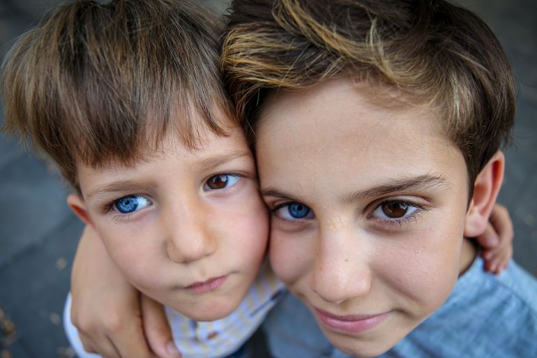 في تركيا.. شقيقان لكل منهما عين زرقاء وأخرى بنية