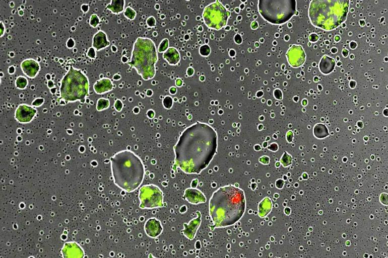 Said سعيد - يوريك ألرت/ تشكل قطيرات مائية صغيرة حول الخلايا البكتيرية والتجمعات الخلوية على السطح الجاف لورقة نباتية – متاح الاستخدام - قطيرات الماء على الأوراق تعطي قبلة الحياة لبكتيريا النبات