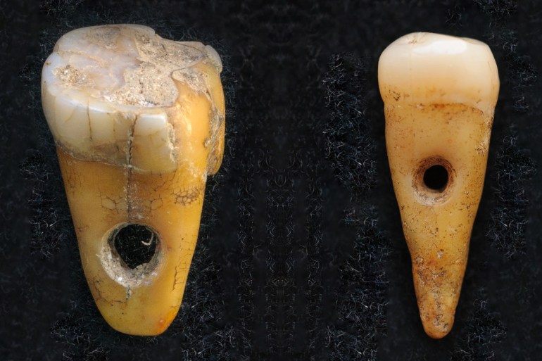 الثقب المخروطي الدقيق لاثنين من الأسنان المكتشفة في تشاتالهوك، تركيا (دكتور سكوت هادو من جامعة كوبنهاجن للجزيرة)