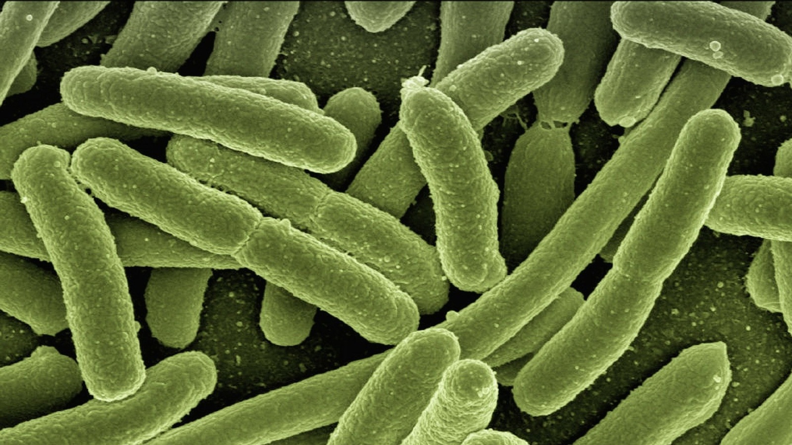 ‪البكتيريا تستخدم رسائل كيميائية في حالات الحرب بين بعضها البعض أو تستخدمها أحيانا ضد بعض خلايا الجسم‬ (بيكسابي)