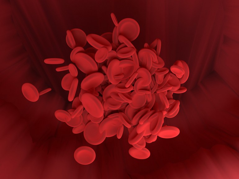 صورة انيميا خلايا الدم الحمراء من بيكسابي