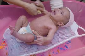قد يعاني الأطفال الذين يأخذون الحمام الأول مباشرة بعد الولادة من البرد مما يؤدي إلى انخفاض حرارتهم (الجزيرة)