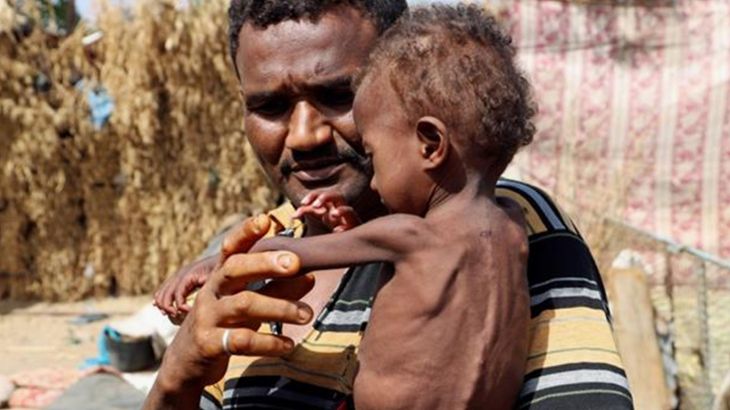 الأمم المتحدة: 75 مليون طفل يواجهون مشكلات صحية بسبب الجوع