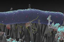 طبوغرافية جناح الحشرة النانوي يعيق البكتيريا عن النمو (يوريك ألرت)