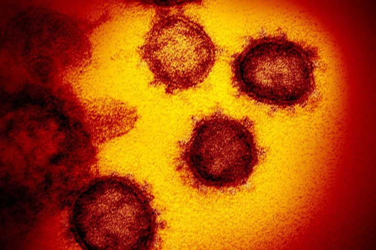 كورونا مجهر An undated transmission electron microscope image shows SARS-CoV-2, also known as novel coronavirus, the virus that causes COVID-19, isolated from a patient in the U.S., emerging from the surface of cells cultured in the lab. NIAID-RML/Handout via REUTERS. THIS IMAGE HAS BEEN SUPPLIED BY A THIRD PARTY. MANDATORY CREDIT