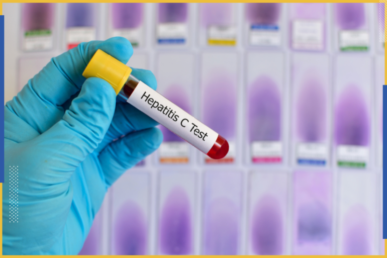Blood sample for hepatitis C virus (HCV) testing