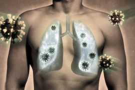 illustrative image of lung damage by coronavirus covid-19. Human anatomy. Concept; Shutterstock ID 1692541417; Department: -