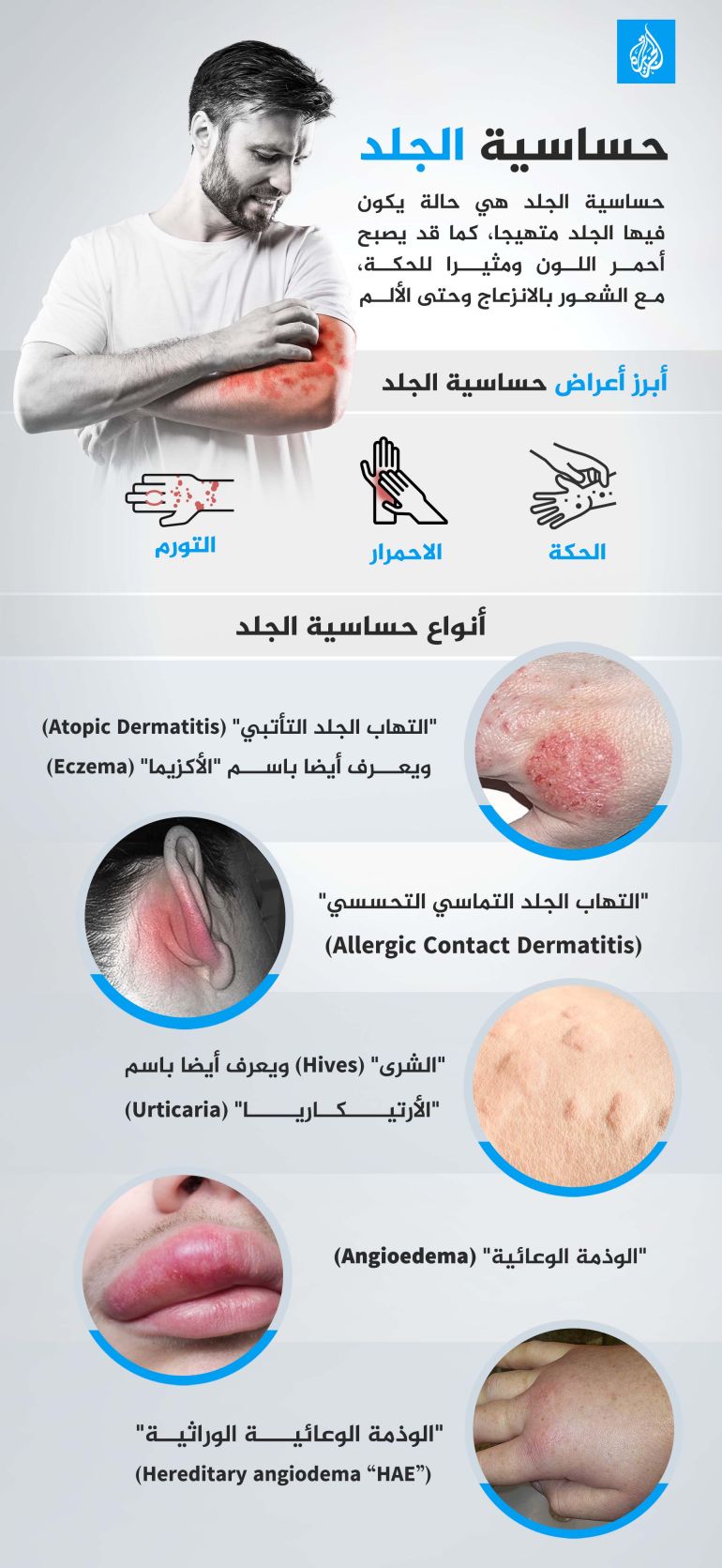 إنفوغراف حساسية الجلد إكزيما أكزيما جلدية صحة الجلد