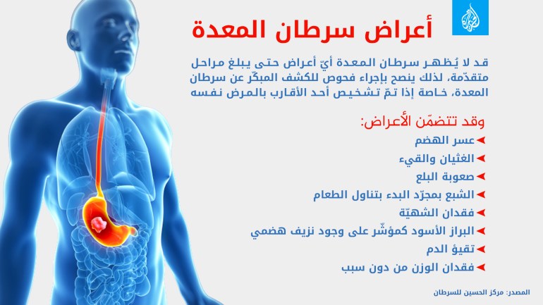 أعراض سرطان المعدة