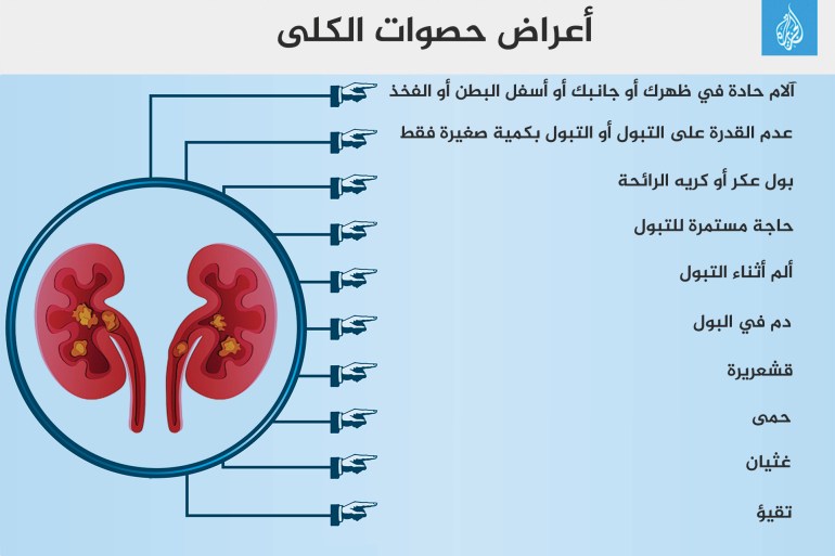انفوجراف أعراض حصوات الكلى Kidney stones حصوات الكلى حصى الكلى كلى كلية الكليه كليتين