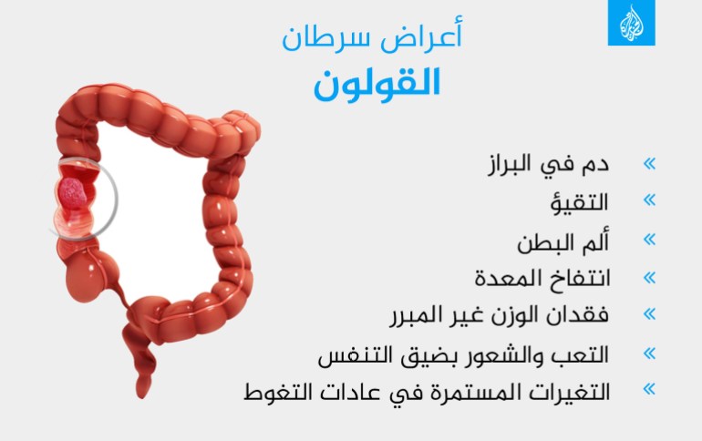 أعراض سرطان القولون